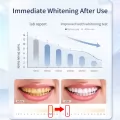 PAP Richer Teeth Whitening Strips +Pen Kit