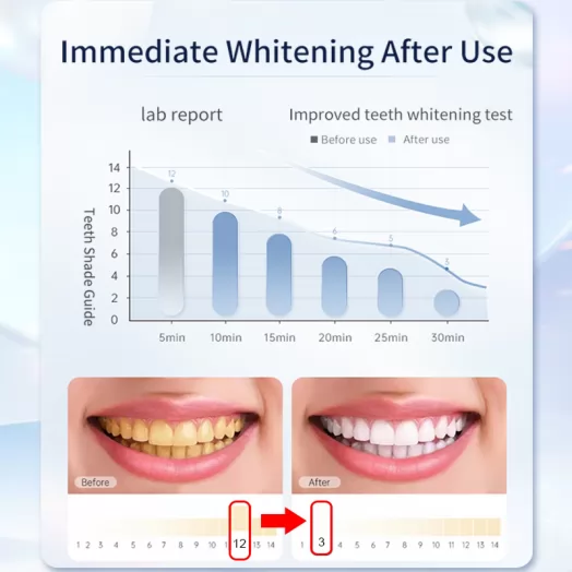 PAP Richer Teeth Whitening Strips +Pen Kit